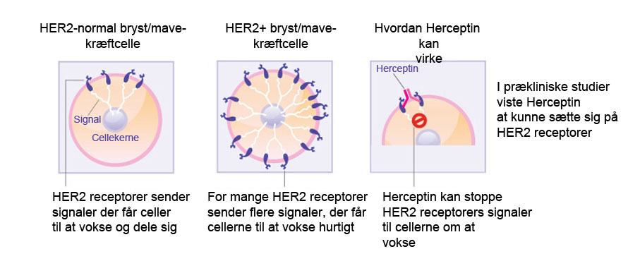 Hvordan Herceptin påvirker brystkræftceller (Kilde: beyondthedish.wordpress.com). Diagram, der viser hvordan Herceptin kan virke på brystkræft- eller. HER2 receptorer sender signalet til en celle om at vokse og dele sig; for mange HER2 receptorer får brystkræft- eller mavekræftceller til at vokse for hurtigt. I prækliniske studier, viste Herceptin sig at forbinde sig med HER2 receptorer, hvilket kan stoppe receptorernes signaler til cellen om at vokse.